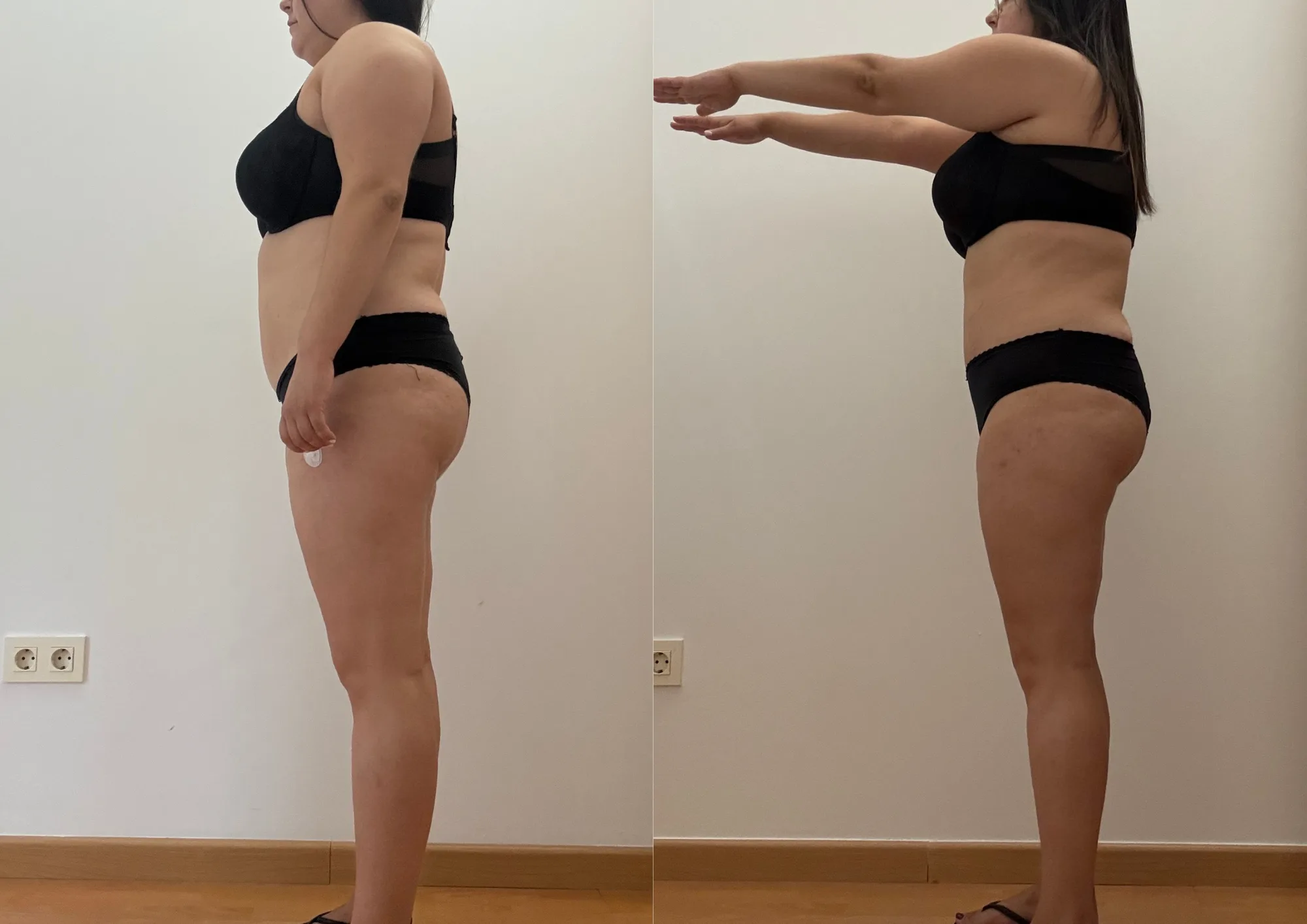 Evolución física de Clara vista de perfil, antes y después